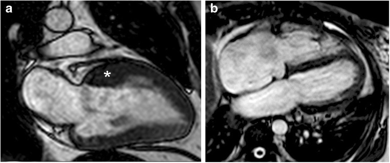 Fig. 13