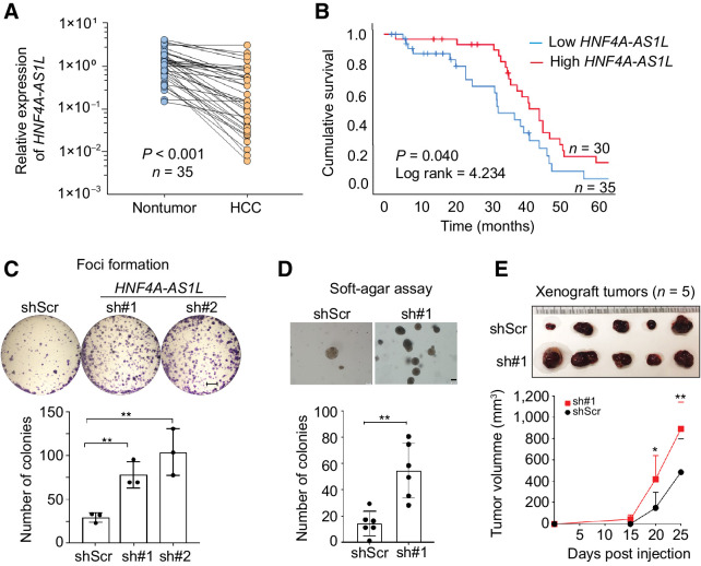 Figure 3. Silencing of HNF4A-AS1L promotes tumorigenesis in HCC. A, qPCR analysis of HNF4A-AS1L expression was conducted in 35 matched pairs of HCC tumors and their NT liver samples (paired Student t test). The expression of HNF4A-AS1L transcripts in each sample was calculated by the formula described in Fig. 1B and normalized to the average expression in all the NT tissues (defined as 1.0). B, Kaplan–Meier plots for the overall survival rate of patients with HCC regarding their HNF4A-AS1L expression status in tumor. Expression of HNF4A-AS1L was measured in 89 patients by qPCR. The relative expression of HNF4A-AS1L in tumors was normalized to the average relative expression in all tumor samples, which was defined as 1.0. Overall survival rates for the top 40% (high expression, n = 30*) and bottom 40% (low expression, n = 35*) of patients were compared (log rank test). *, only patients with available survival data were included in this analysis. C, Quantification of foci formation induced by the indicated cells. Scale bar, 5 mm. D, Quantification of colonies formed in soft agar induced by the indicated clones. Scale bar, 200 μm. E, Images of xenograft tumors derived from the indicated cells (n = 5 mice per group) at end point (top). Growth curves of tumors derived from the indicated cells (bottom) over a 25-day period. Statistical significance was determined by paired, two-tailed Student t test (*, P < 0.05; **, P < 0.01). C and D, Data are presented as the mean ± SEM of technical triplicates (C) or six replicates (D) from a representative experiment of three independent experiments. Statistical significance was determined by unpaired, two-tailed Student t test (**, P < 0.01).