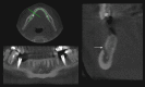Figure 6A