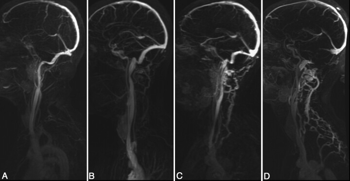 Fig 2.