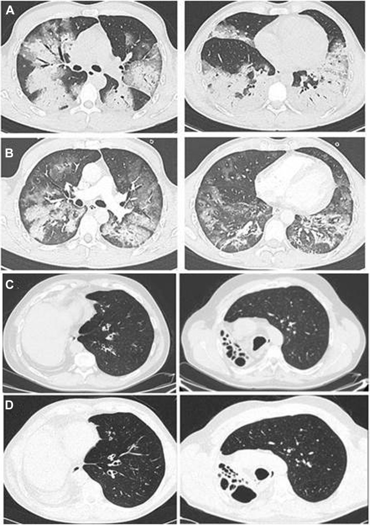 Fig. 1