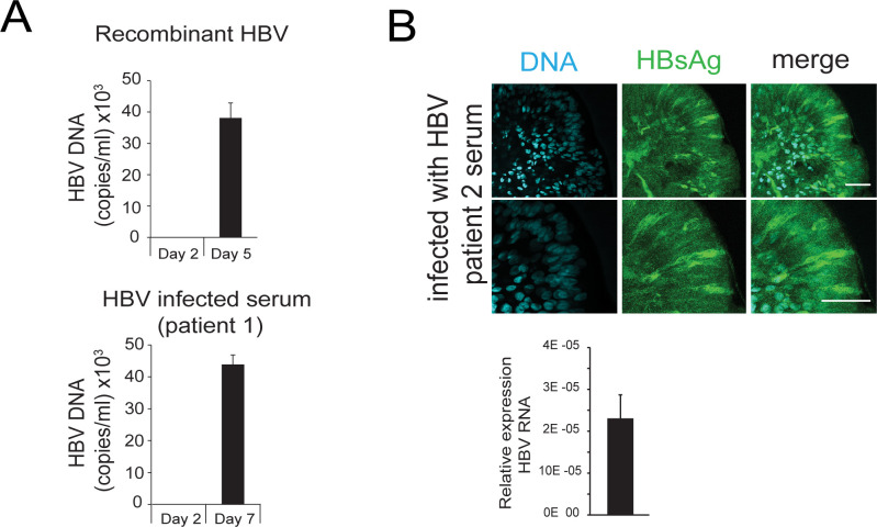 Figure 1—figure supplement 3.