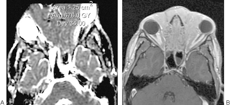 Fig. 12