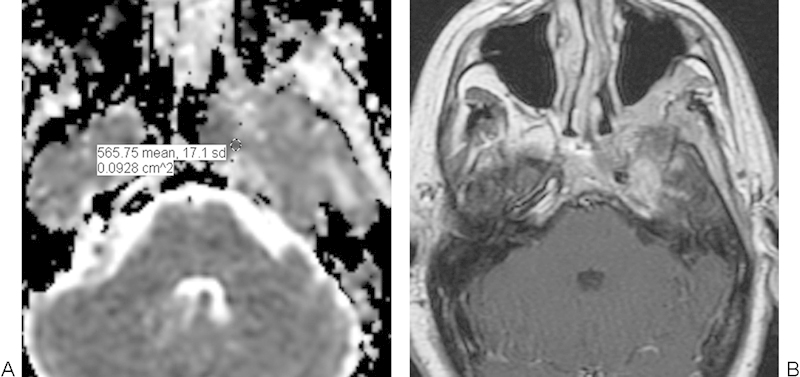 Fig. 14