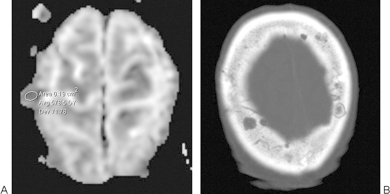 Fig. 13