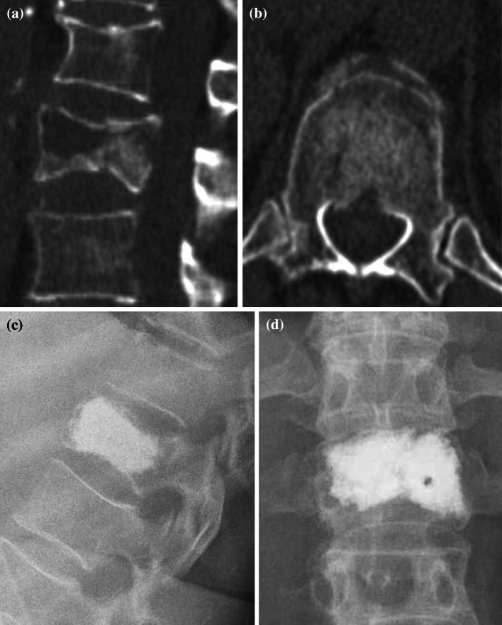 Fig. 2