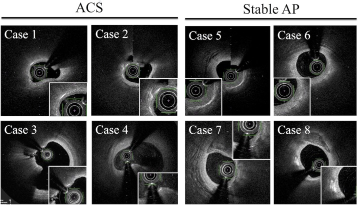 Fig 7