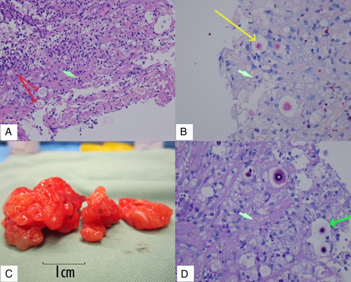 Figure 2