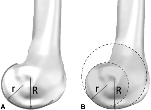 Fig. 4A–B