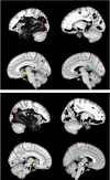 Supplementary Image