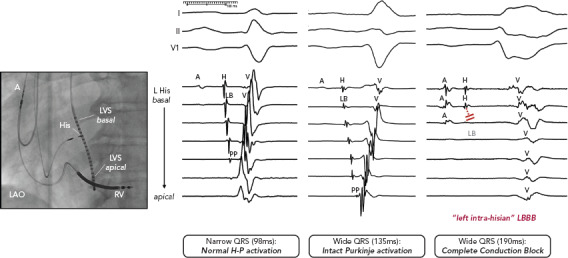 Figure 1: