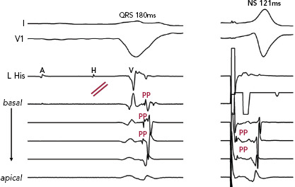 Figure 3: