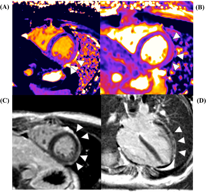 Fig 3