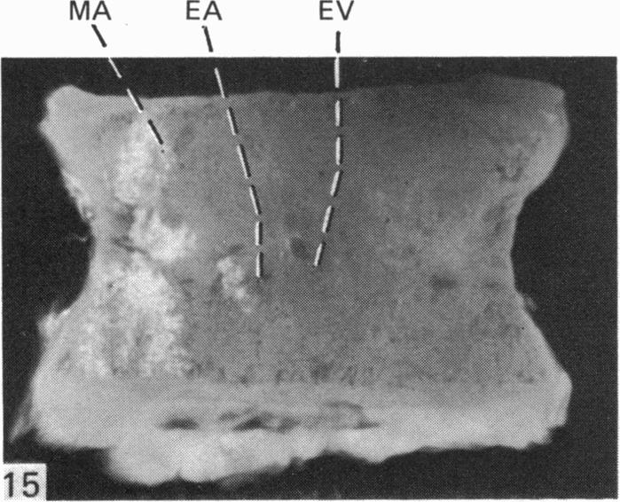 Fig. 15