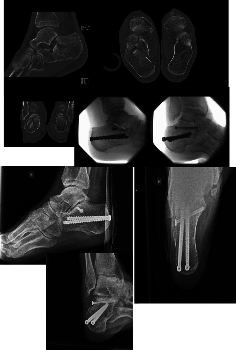 Fig. 1