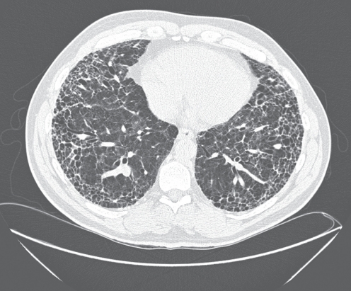 Figure 3)