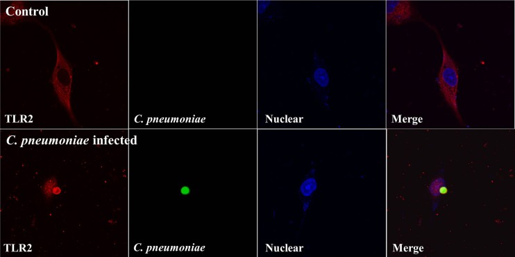 Fig 2