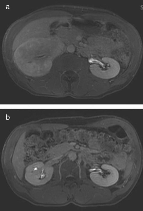 Fig 2.