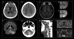Fig.1