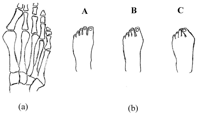 Figure 29