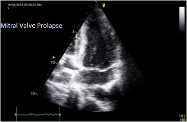 Figure 4