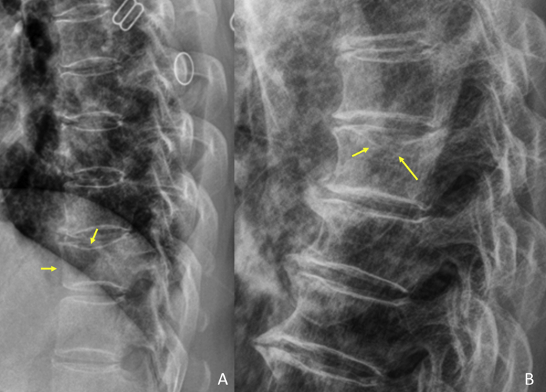 Figure 3