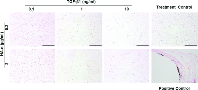 FIG. 12.