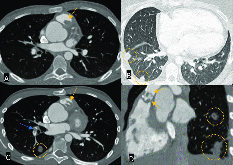 Fig. 12