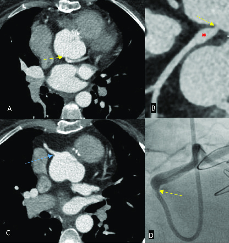 Fig. 21