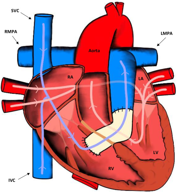 Fig. 4