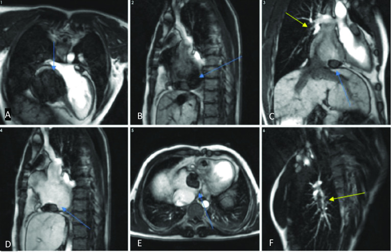 Fig. 24