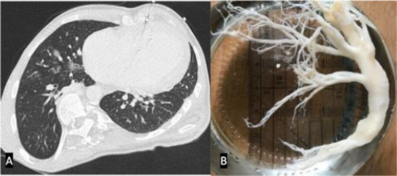 Fig. 16