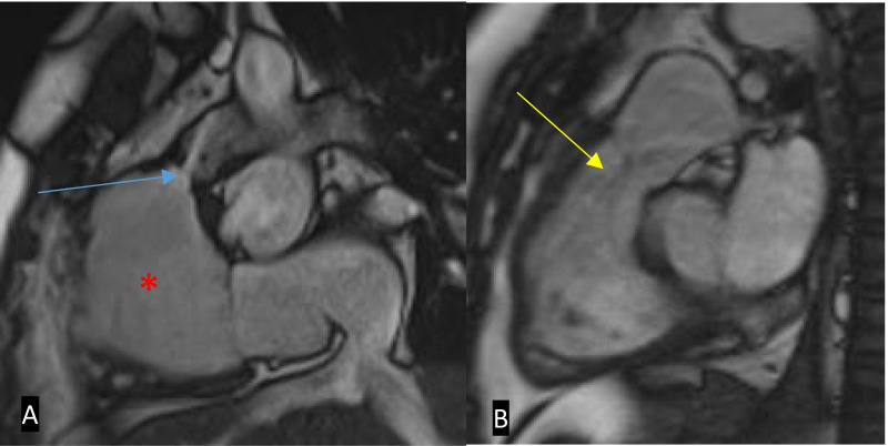 Fig. 18