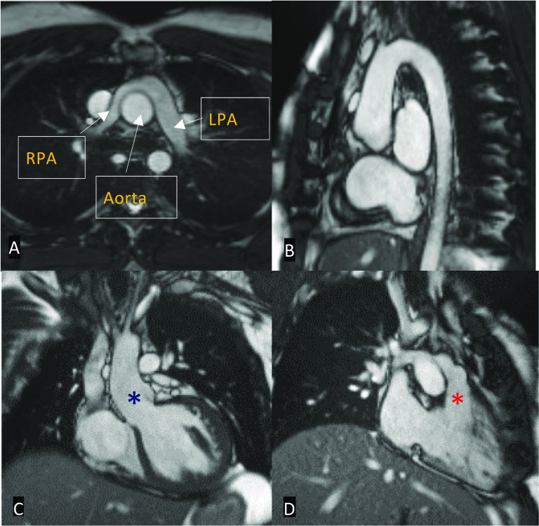 Fig. 13