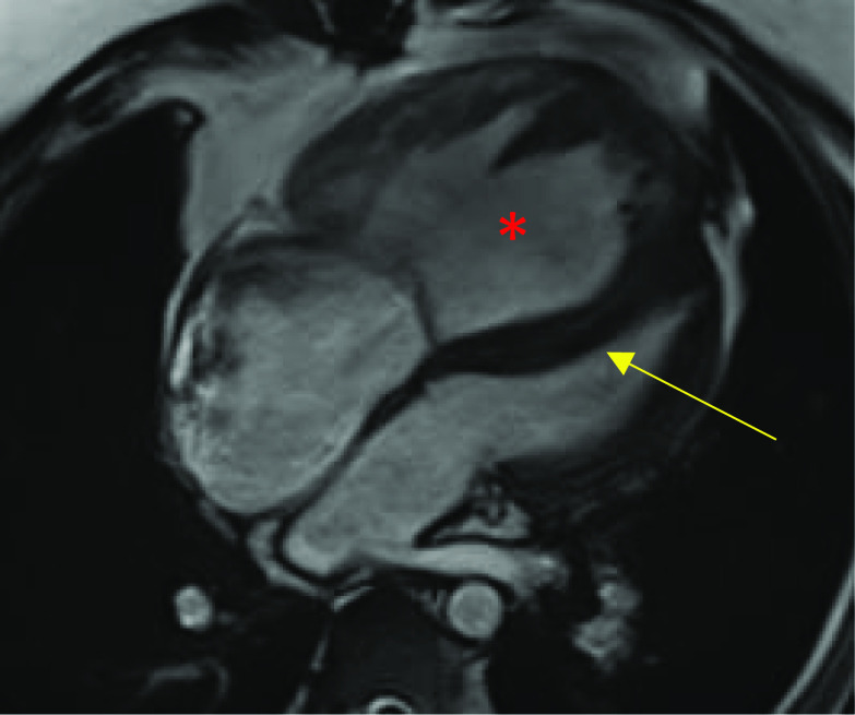 Fig. 10