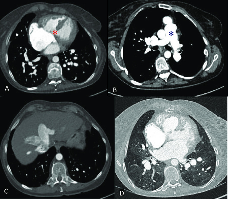 Fig. 14