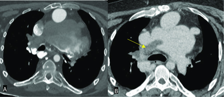 Fig. 9