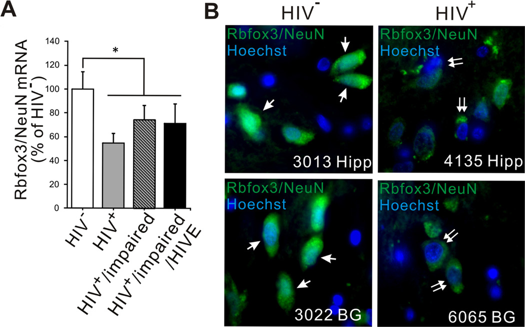 Fig. (1)