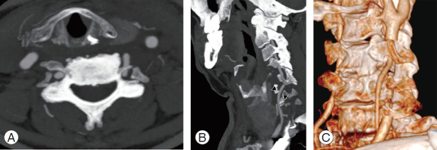 Fig. 13.