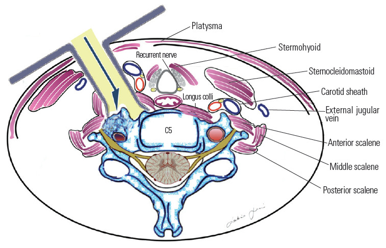 Fig. 15.