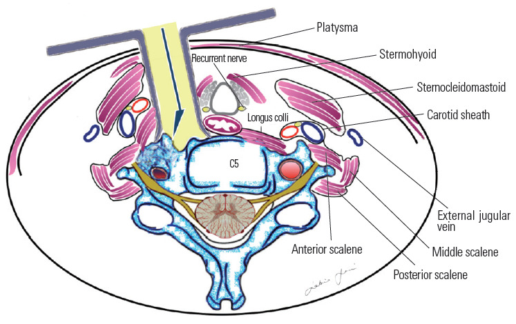 Fig. 14.