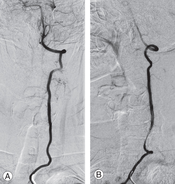 Fig. 11.