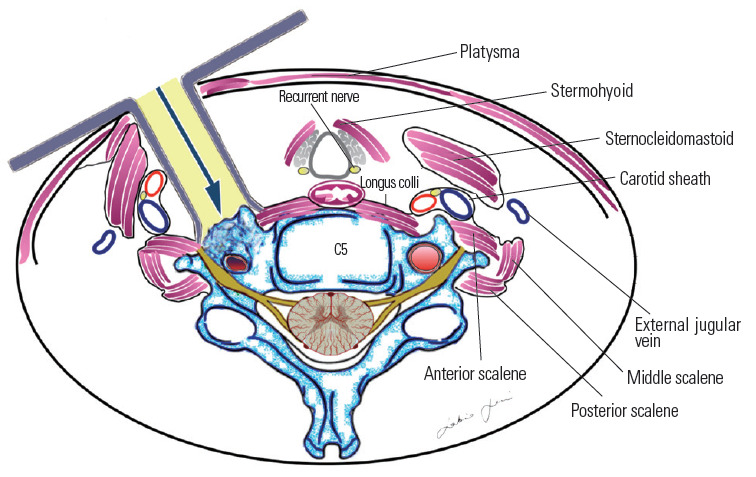 Fig. 16.