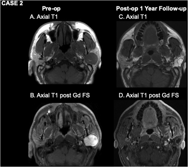 Figure 2