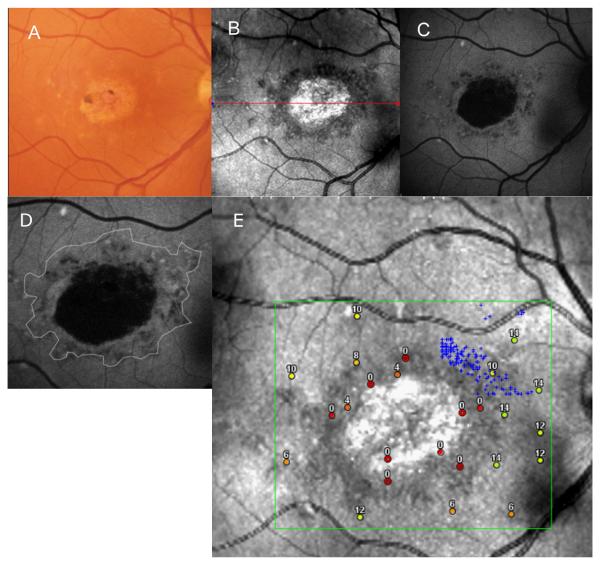 FIGURE 1