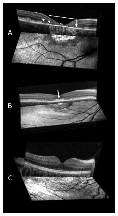 FIGURE 3