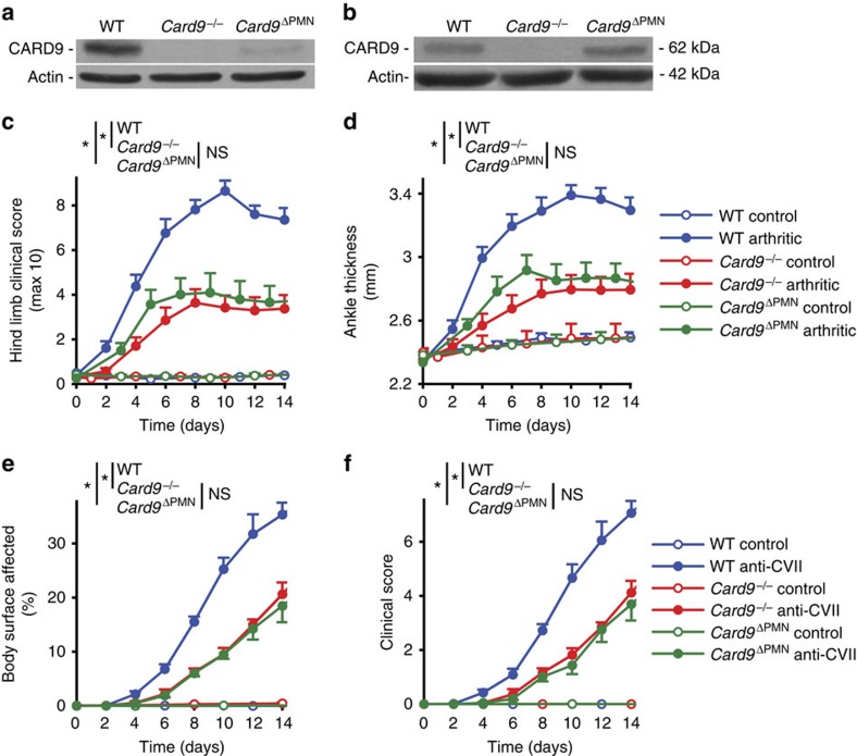 Neutrophil-specific deletion of the CARD9 gene expression regulator ...