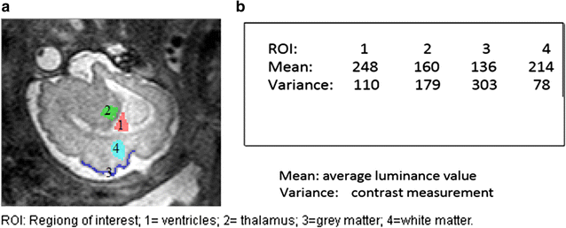 Fig. 5