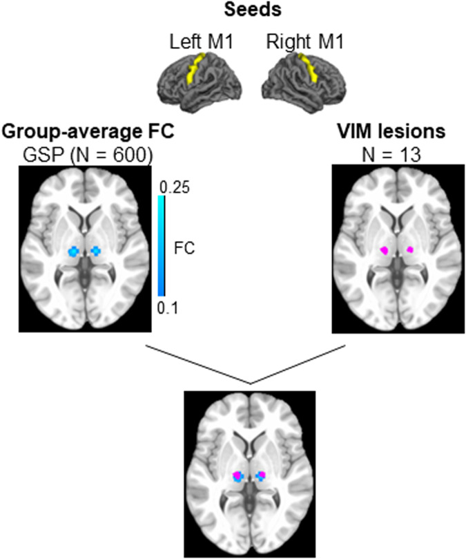 Fig. 2