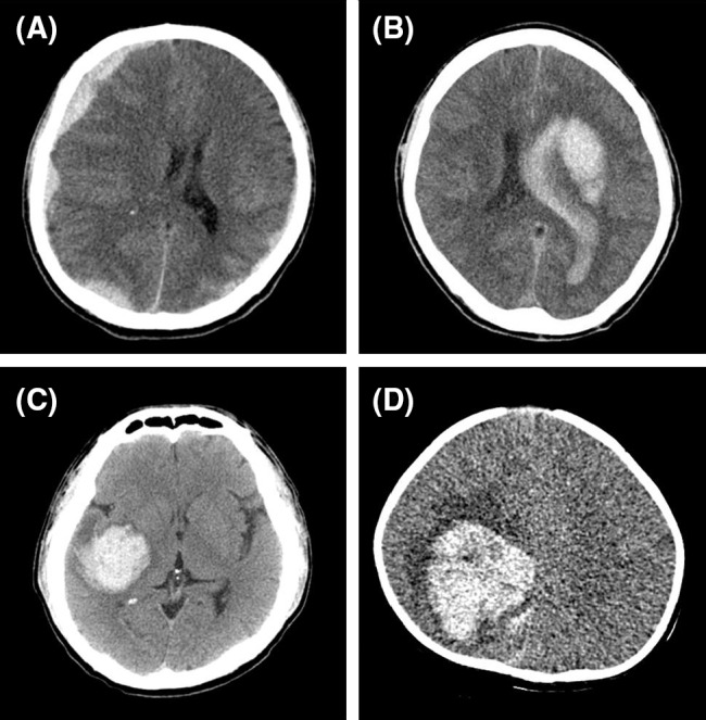 Fig. 1